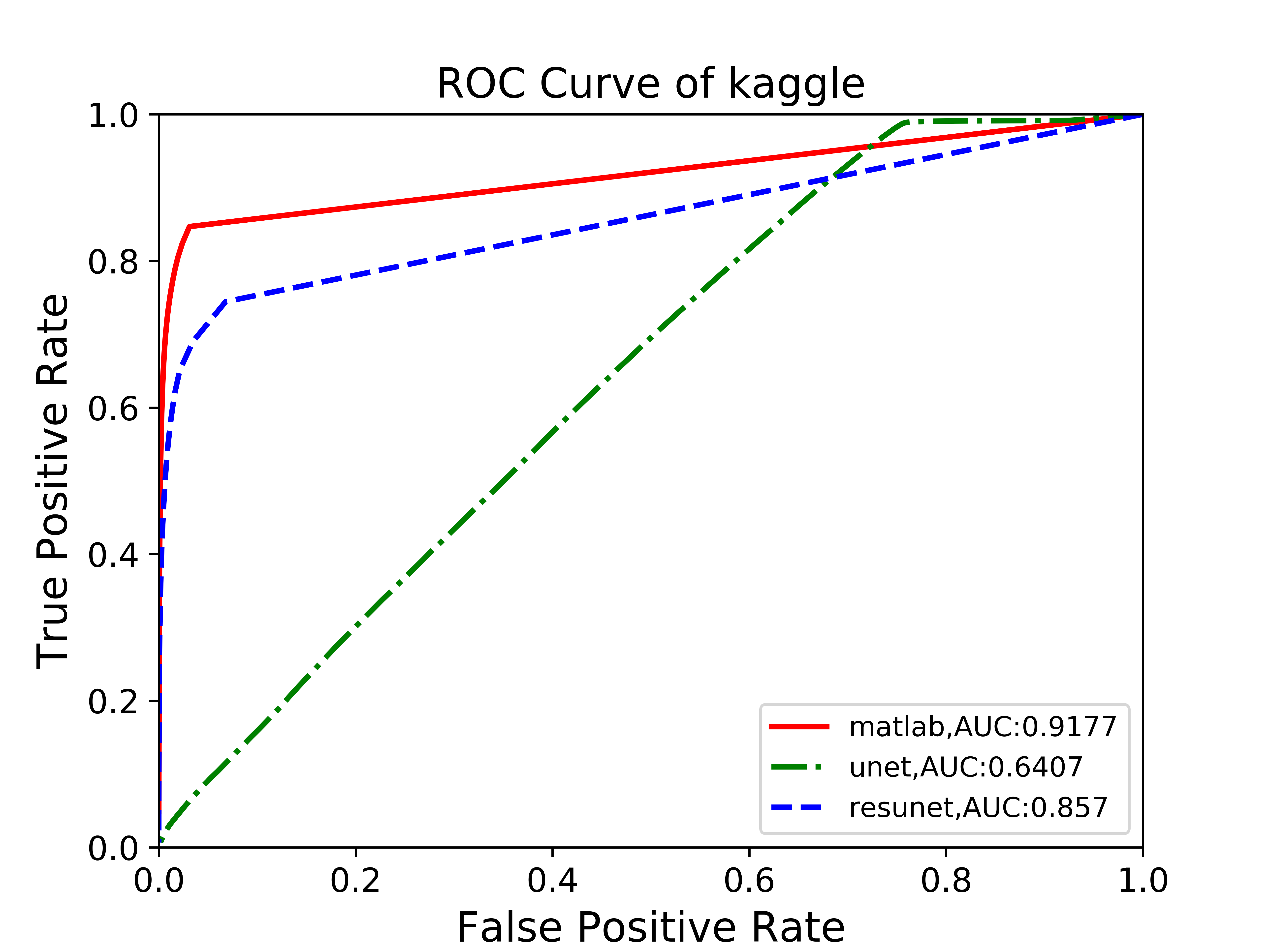 kaggle_ROC.png