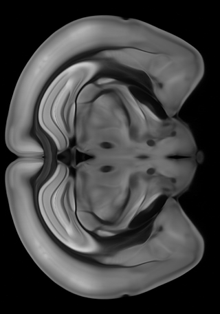 average image - coronal slice 300