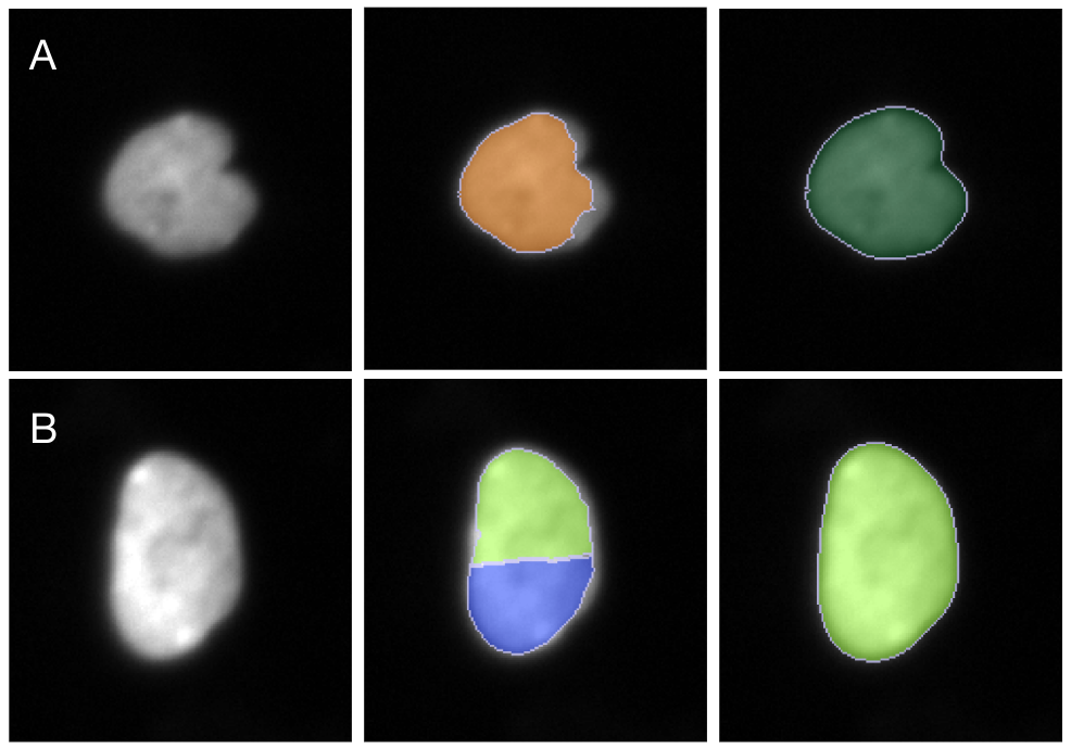 Nuclei_Segmented