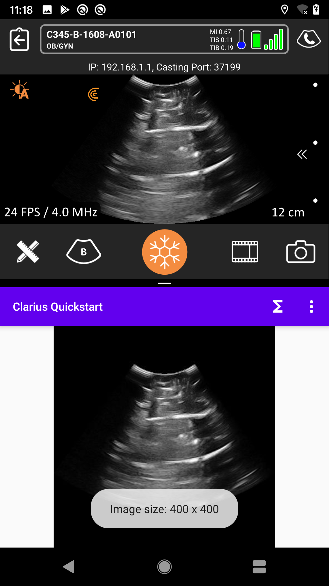 split screen imaging