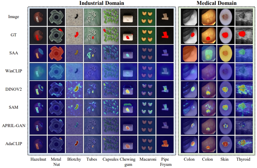 Fig_detection_results