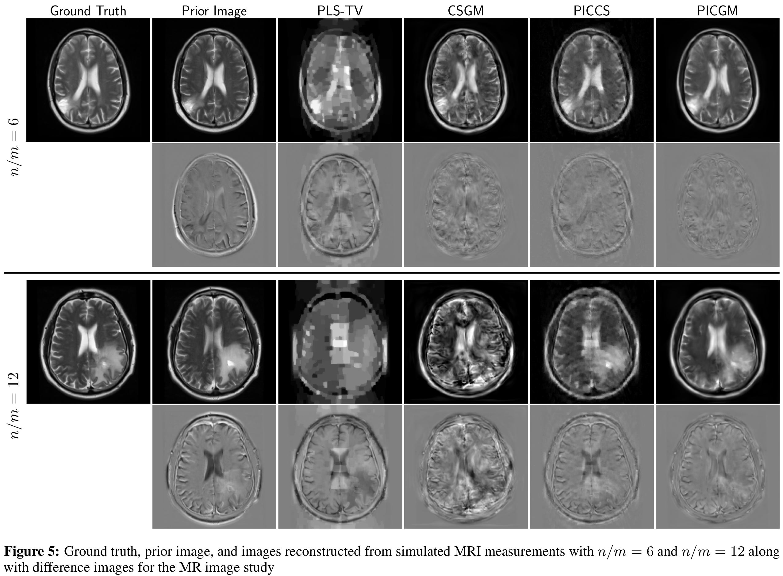 MRI image reconstruction