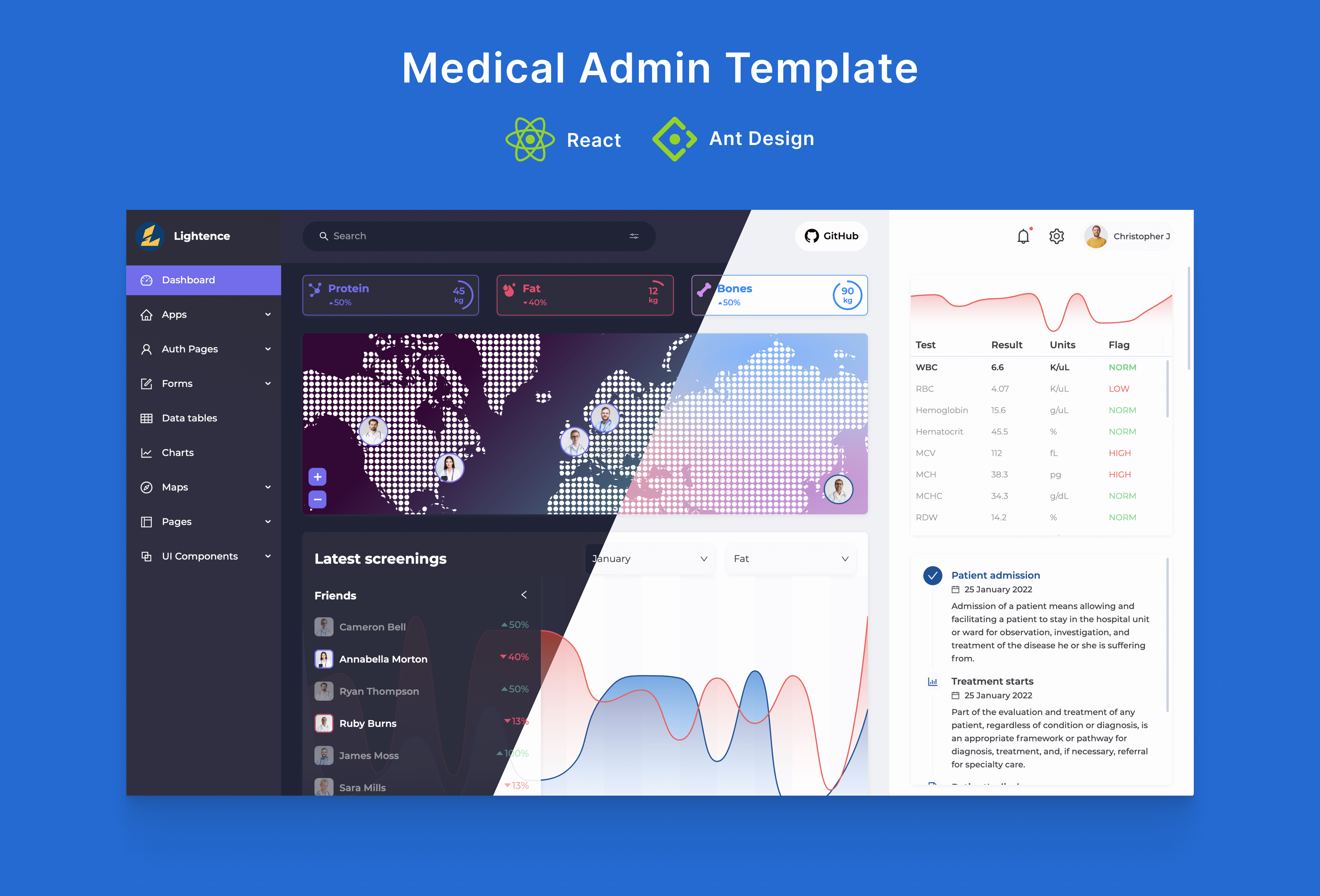 Lightence Admin Template