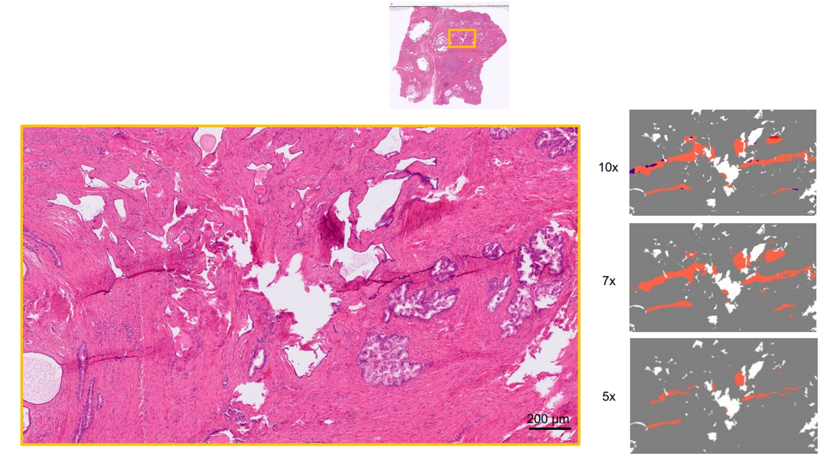 ROI and slide classification results