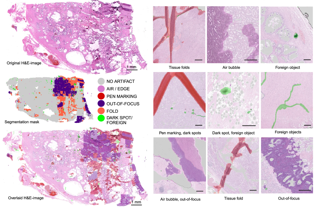 ROI and slide classification results