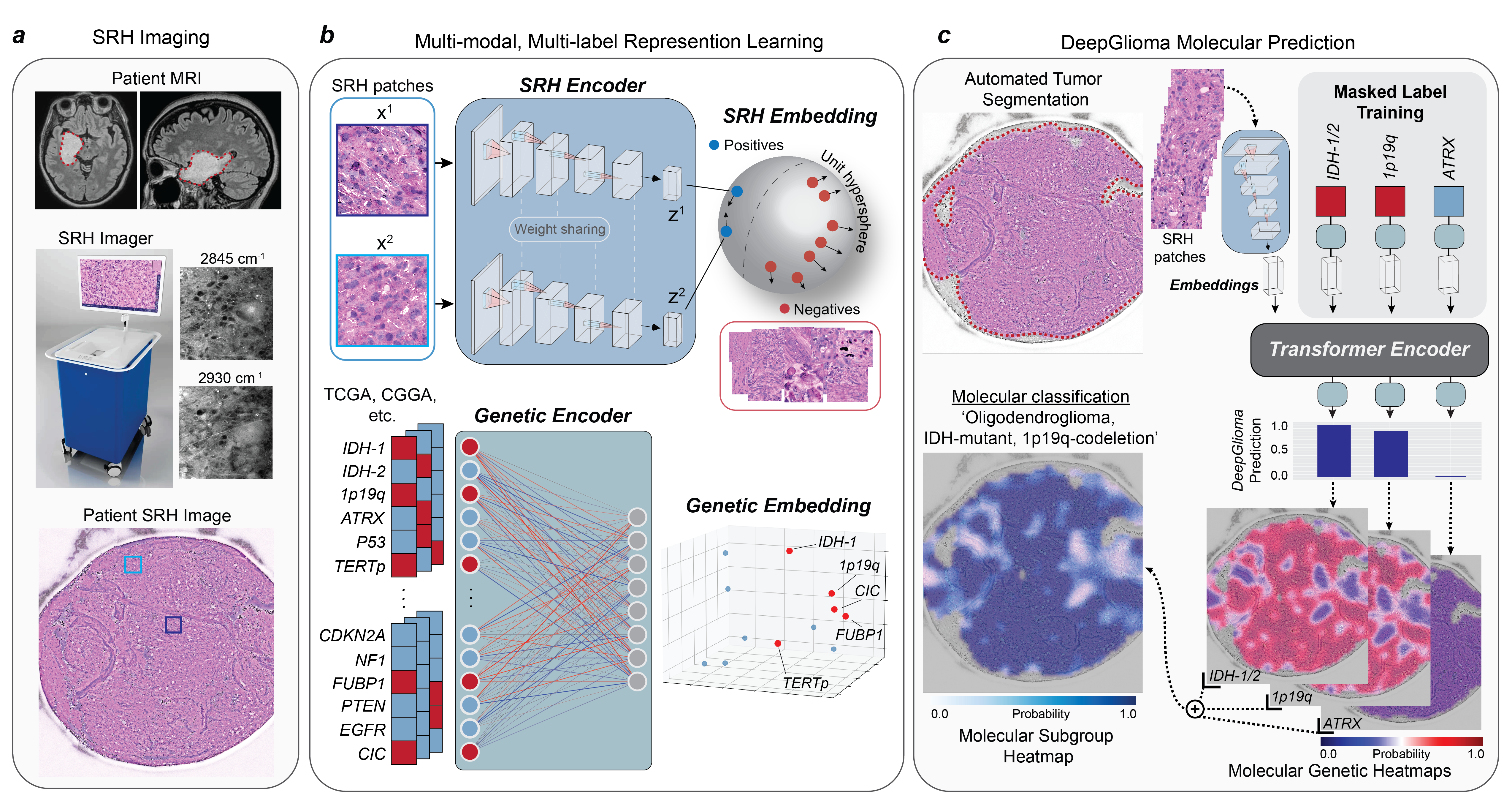 DeepGlioma Workflow