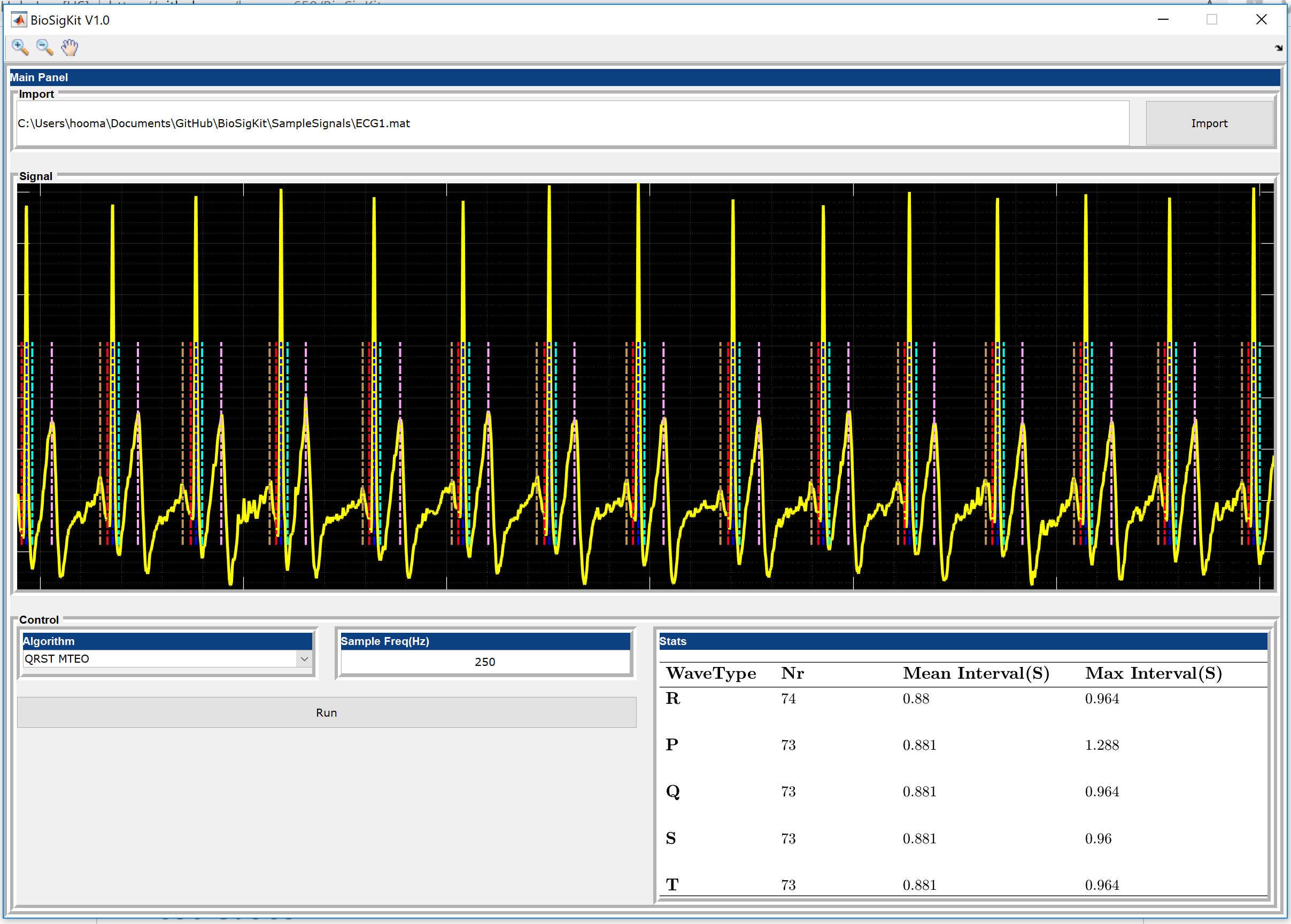 Graphical User Interface of BioSigKit. The algorithm pop-up menu provides an easy way for the selection of the QRS detection algorithm. The statistics panel automatically computes mean, maximum and minimum detected intervals.