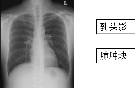 公开数据集举例